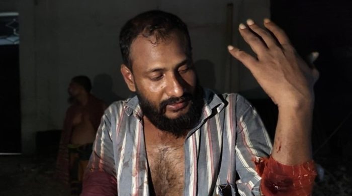 আশুলিয়ায় শ্রমিক দল নেতার বাসায় গুলিবর্ষণ, আহত ৬